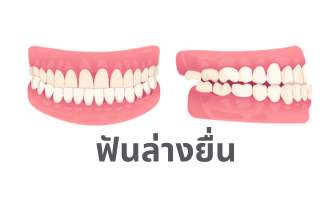 เว็บ 2 (332 x 332 px) (332 x 200 px) (1)