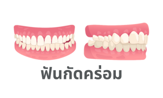 เว็บ 2 (332 x 332 px) (332 x 200 px) (2)
