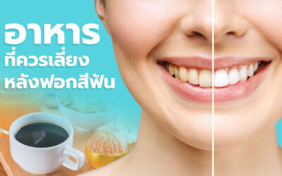 อาหารที่ควรเลี่ยงหลังฟอกสีฟัน