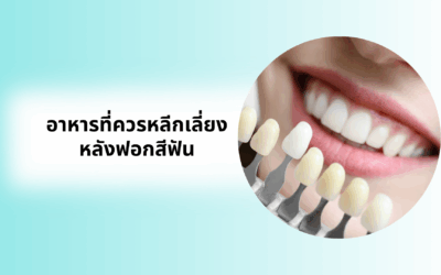 อาหารที่ควรหลีกเลี่ยงหลังฟอกสีฟัน